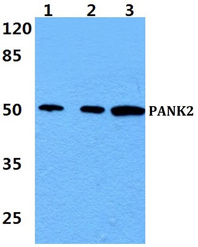 PANK2 Antibody in Western Blot (WB)