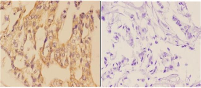 AANAT Antibody in Immunohistochemistry (Paraffin) (IHC (P))