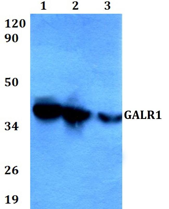 GALR1 Antibody in Western Blot (WB)