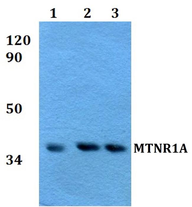 MTNR1A Antibody in Western Blot (WB)