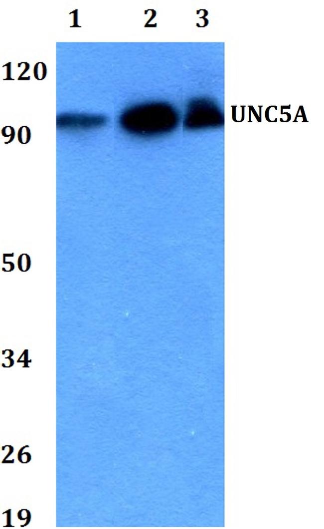 UNC5A Antibody in Western Blot (WB)