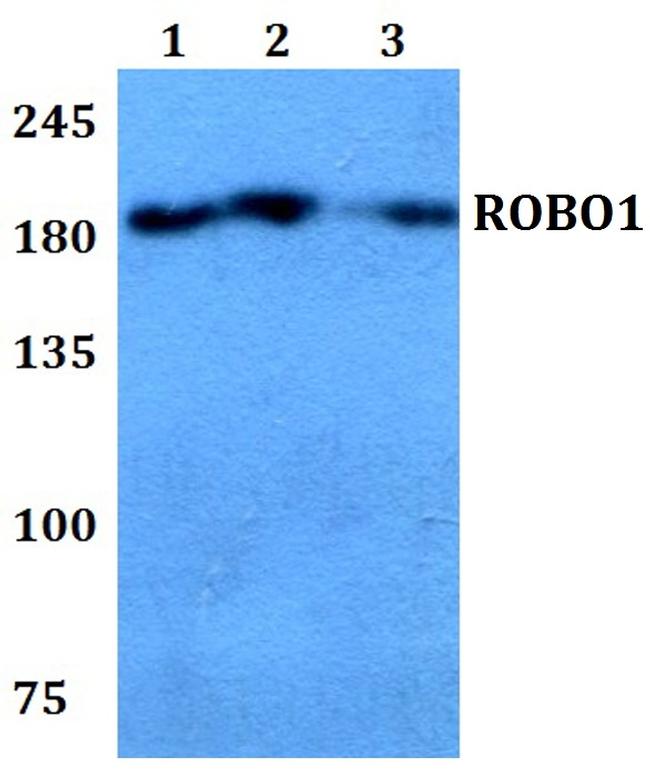 ROBO1 Antibody in Western Blot (WB)