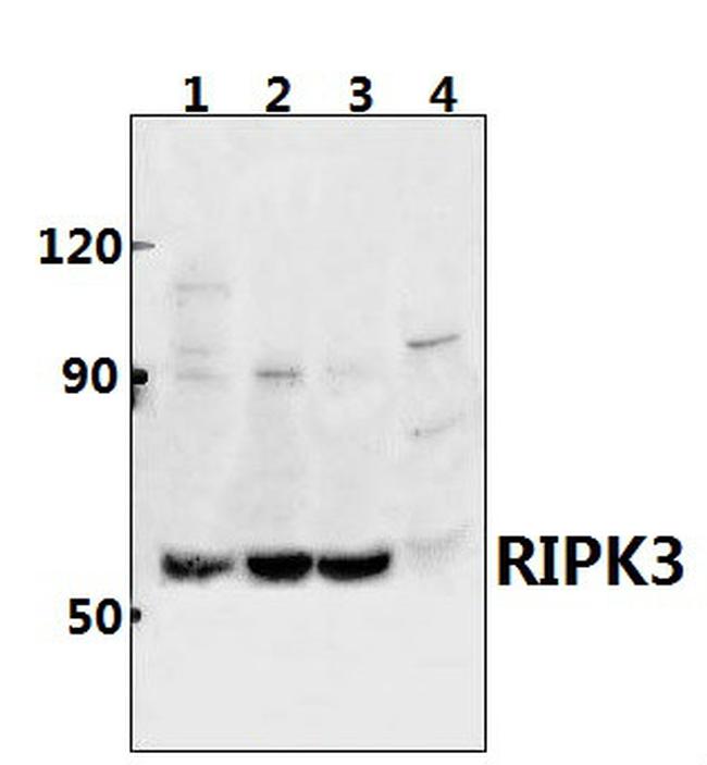 RIP3 Antibody in Western Blot (WB)