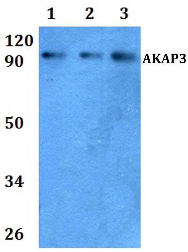 AKAP3 Antibody in Western Blot (WB)