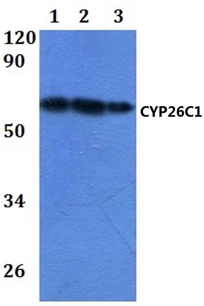 CYP26C1 Antibody in Western Blot (WB)