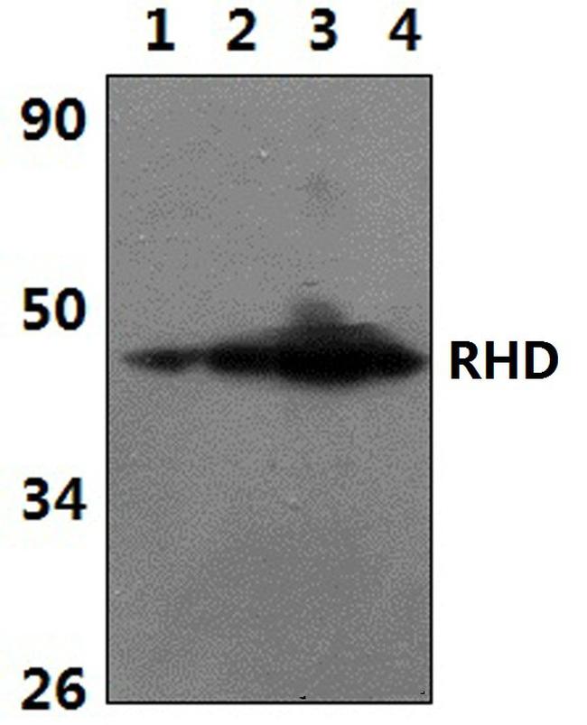 RHD Antibody in Western Blot (WB)