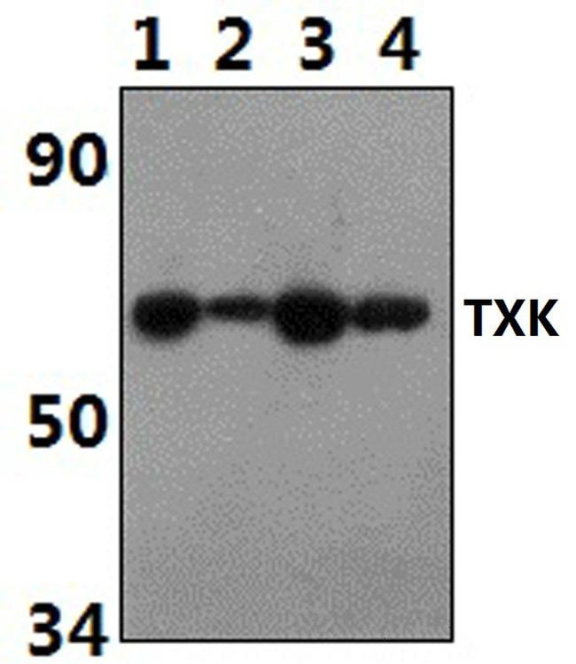 TXK Antibody in Western Blot (WB)