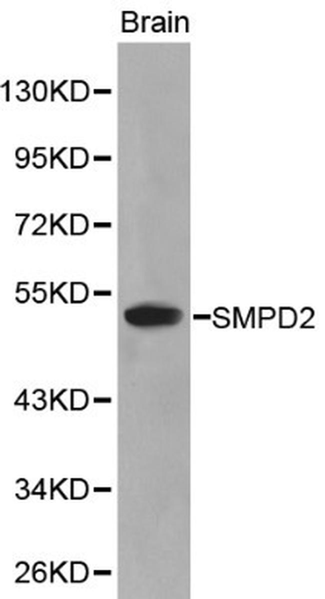 SMPD2 Antibody in Western Blot (WB)