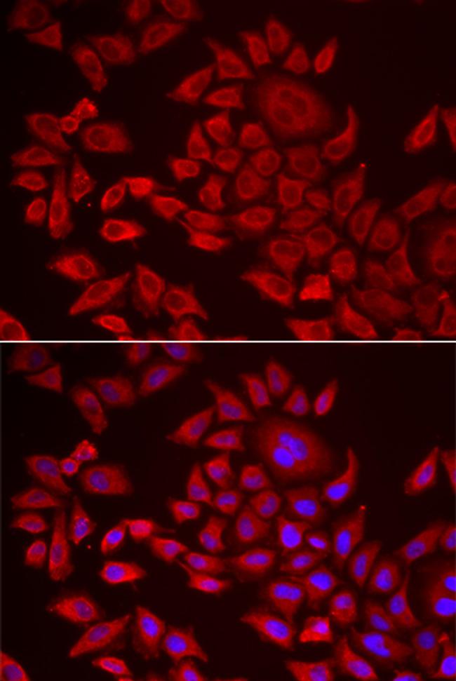 AGPAT2 Antibody in Immunocytochemistry (ICC/IF)