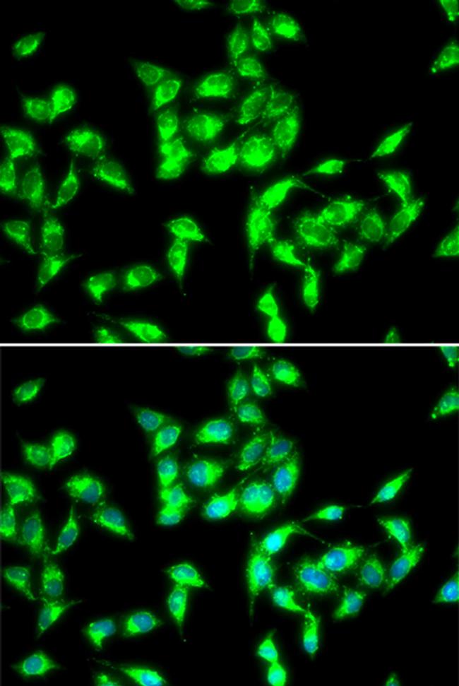 CMG2 Antibody in Immunocytochemistry (ICC/IF)