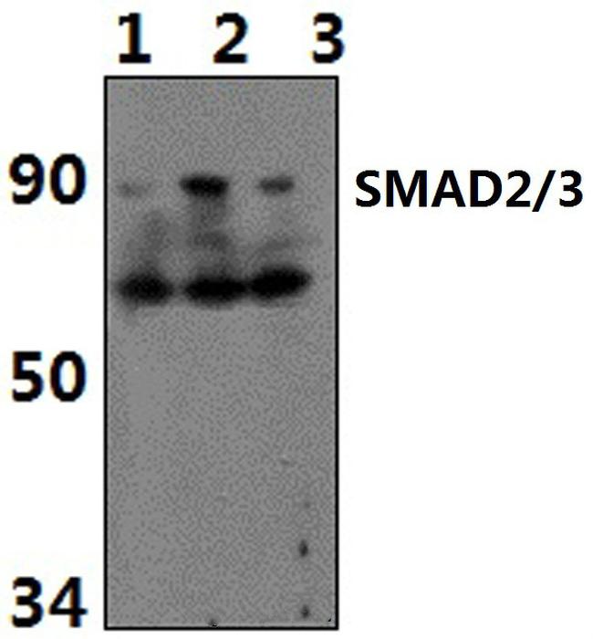 Acetyl-SMAD2/SMAD3 (Lys19) Antibody in Western Blot (WB)