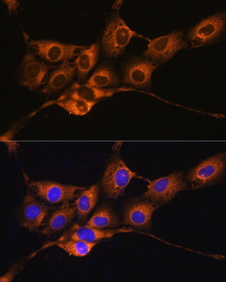 C1 inhibitor Antibody in Immunocytochemistry (ICC/IF)