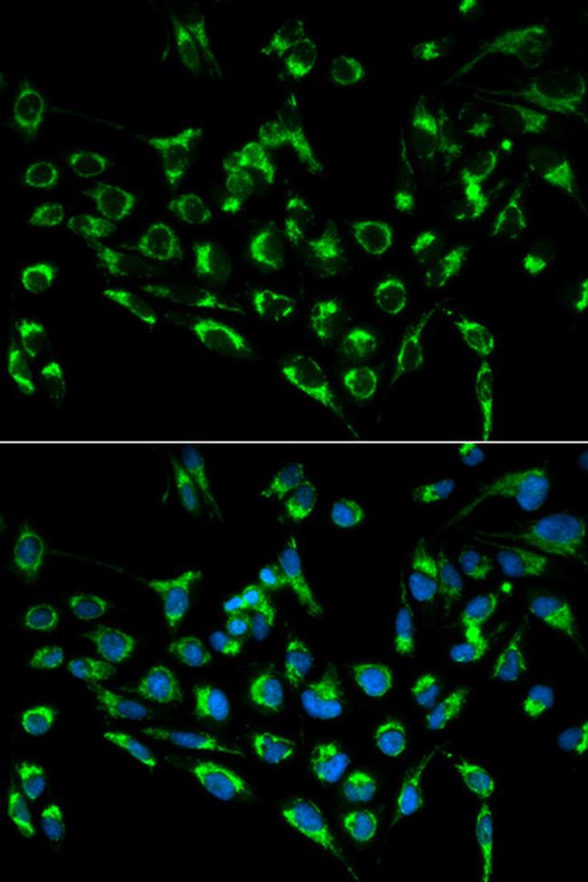 CDKN3 Antibody in Immunocytochemistry (ICC/IF)