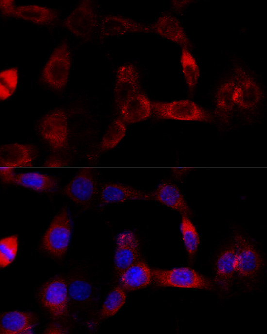 CYP1B1 Antibody in Immunocytochemistry (ICC/IF)