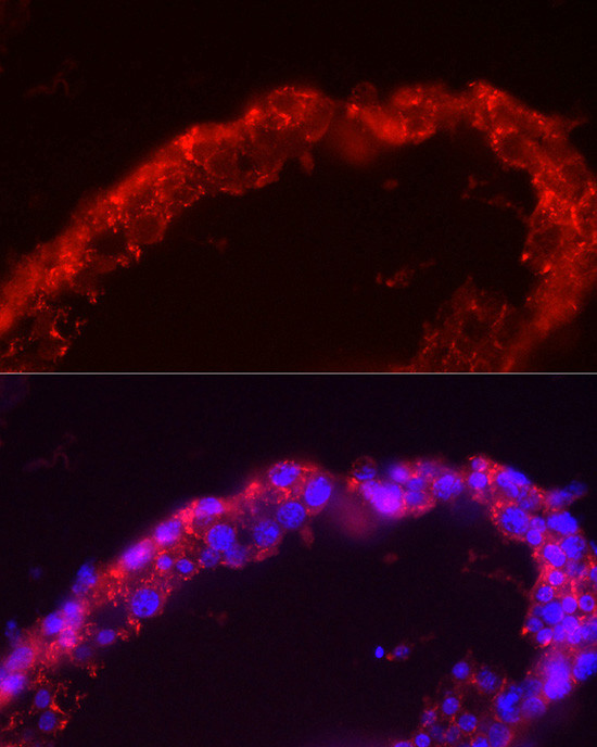 SPAM1 Antibody in Immunocytochemistry (ICC/IF)