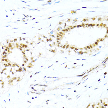 XRCC4 Antibody in Immunohistochemistry (Paraffin) (IHC (P))