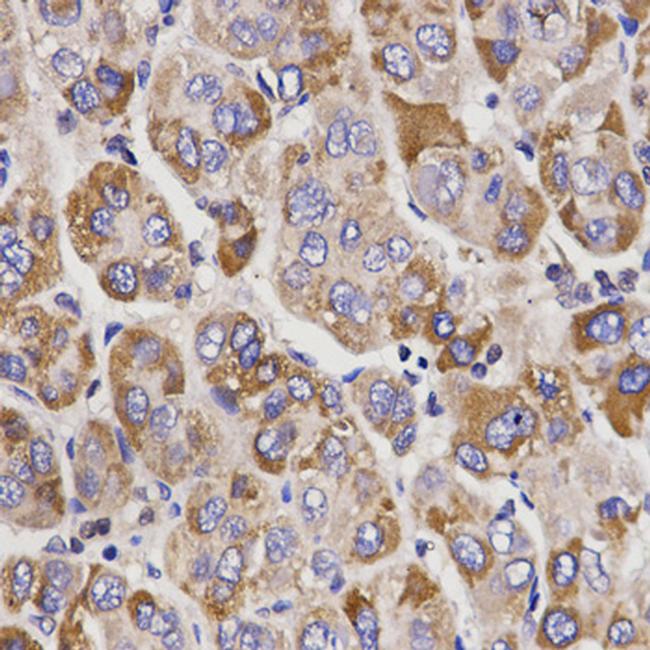 UGT1A9 Antibody in Immunohistochemistry (Paraffin) (IHC (P))