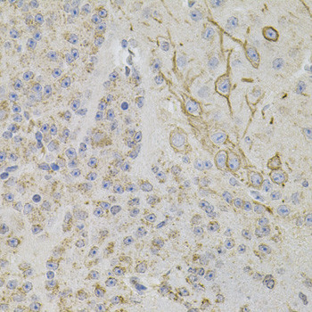 REG3A Antibody in Immunohistochemistry (Paraffin) (IHC (P))