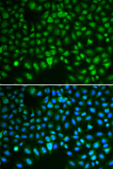 DLG7 Antibody in Immunocytochemistry (ICC/IF)