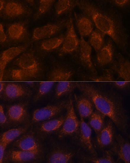 LZIP Antibody in Immunocytochemistry (ICC/IF)