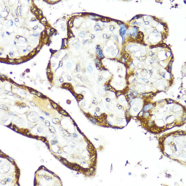 IFNAR2 Antibody in Immunohistochemistry (Paraffin) (IHC (P))