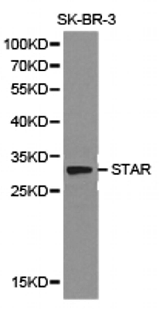 STAR Antibody in Western Blot (WB)