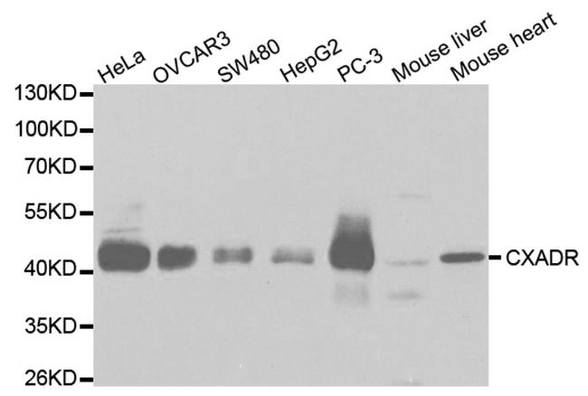 CAR Antibody in Western Blot (WB)