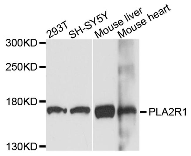 PLA2R1 Antibody in Western Blot (WB)