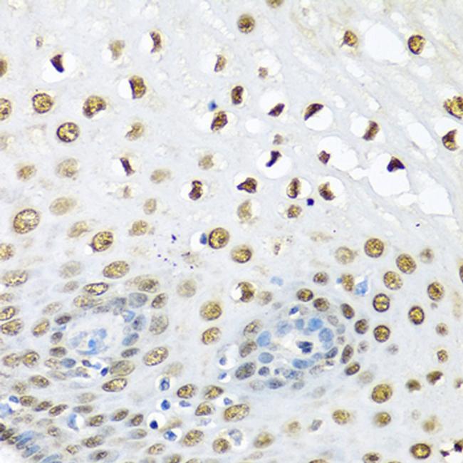 Ubiquitin C Antibody in Immunohistochemistry (Paraffin) (IHC (P))