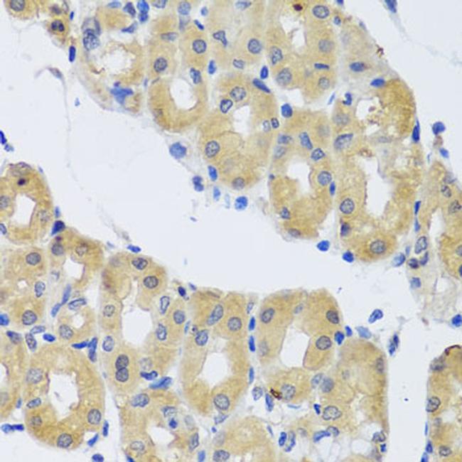 DYNC1I1 Antibody in Immunohistochemistry (Paraffin) (IHC (P))