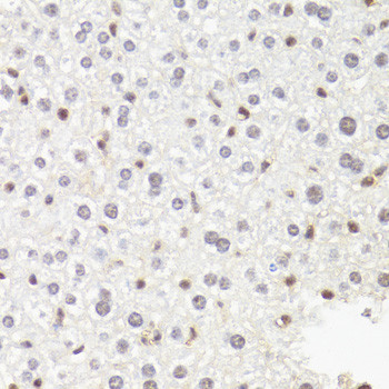 POLR2B Antibody in Immunohistochemistry (Paraffin) (IHC (P))