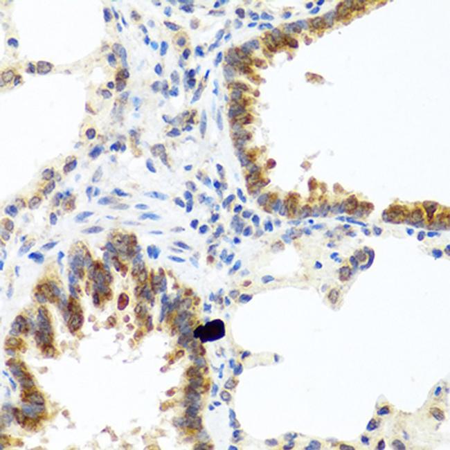 C8orf4 Antibody in Immunohistochemistry (Paraffin) (IHC (P))