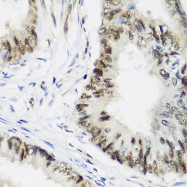 AEBP2 Antibody in Immunohistochemistry (Paraffin) (IHC (P))