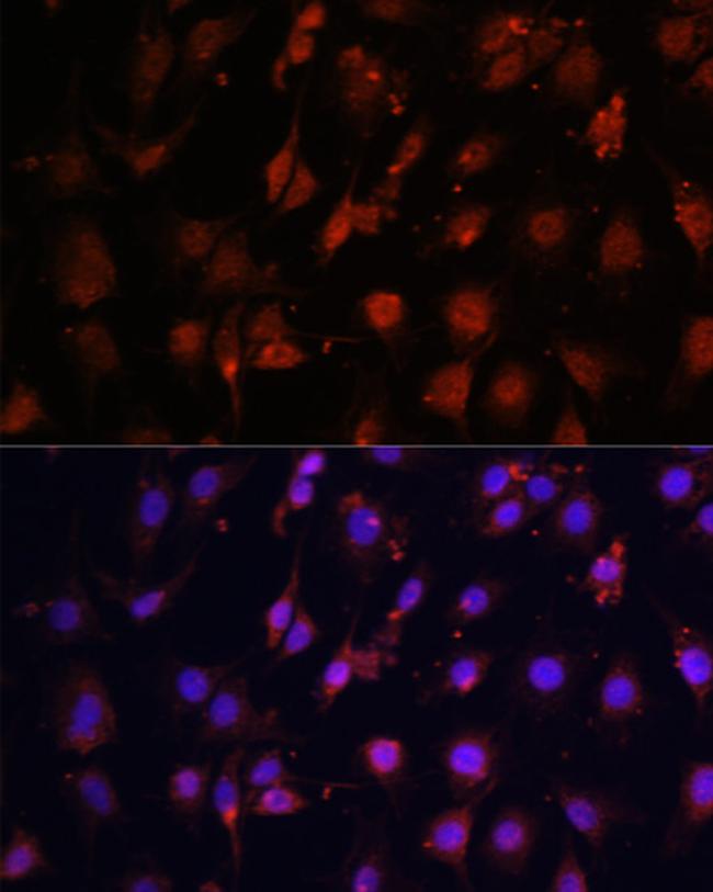 TET3 Antibody in Immunocytochemistry (ICC/IF)