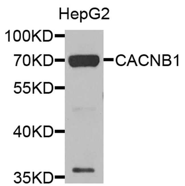 CACNB1 Antibody in Western Blot (WB)