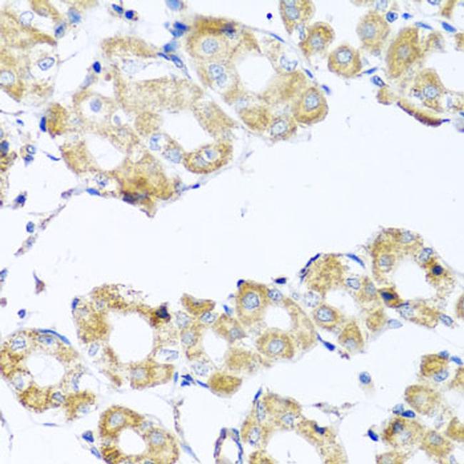 COQ7 Antibody in Immunohistochemistry (Paraffin) (IHC (P))