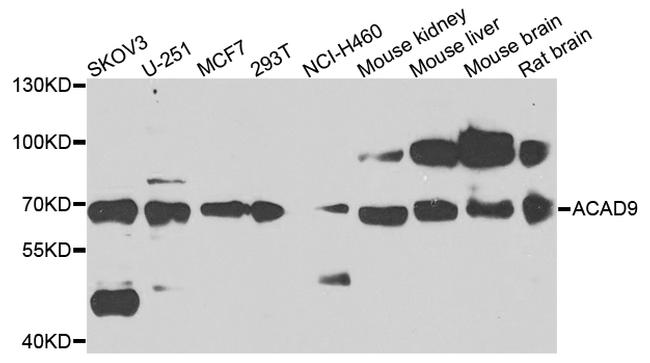 ACAD9 Antibody in Western Blot (WB)