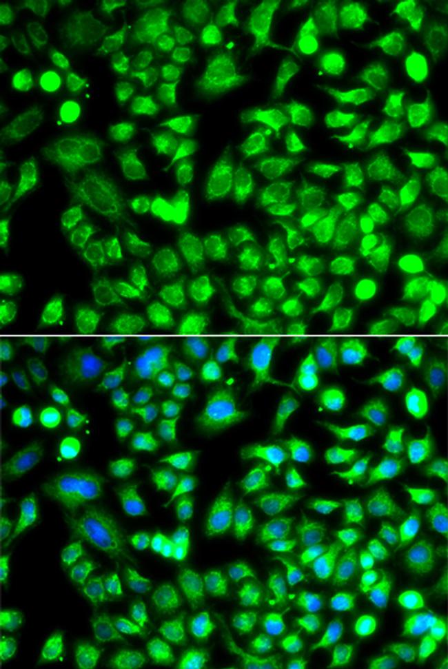 ALKBH4 Antibody in Immunocytochemistry (ICC/IF)