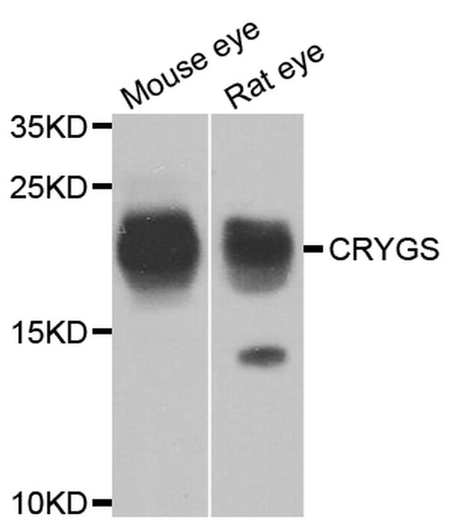 CRYGS Antibody in Western Blot (WB)