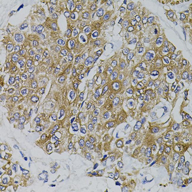 ARHGEF11 Antibody in Immunohistochemistry (Paraffin) (IHC (P))