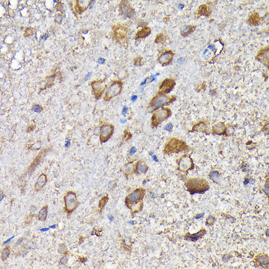 MTHFD1L Antibody in Immunohistochemistry (Paraffin) (IHC (P))