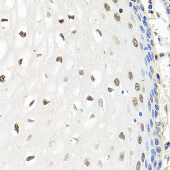 CNOT8 Antibody in Immunohistochemistry (Paraffin) (IHC (P))