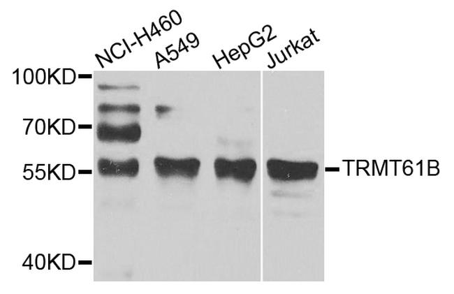 TRMT61B Antibody in Western Blot (WB)