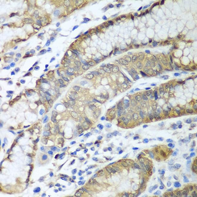 Alcohol Dehydrogenase 1C Antibody in Immunohistochemistry (Paraffin) (IHC (P))