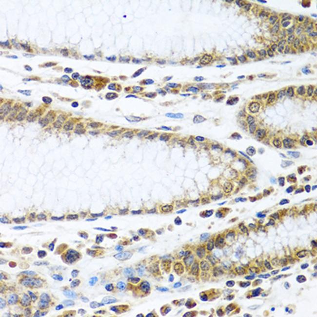 IFI44 Antibody in Immunohistochemistry (Paraffin) (IHC (P))