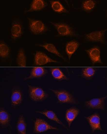 METTL7A Antibody in Immunocytochemistry (ICC/IF)