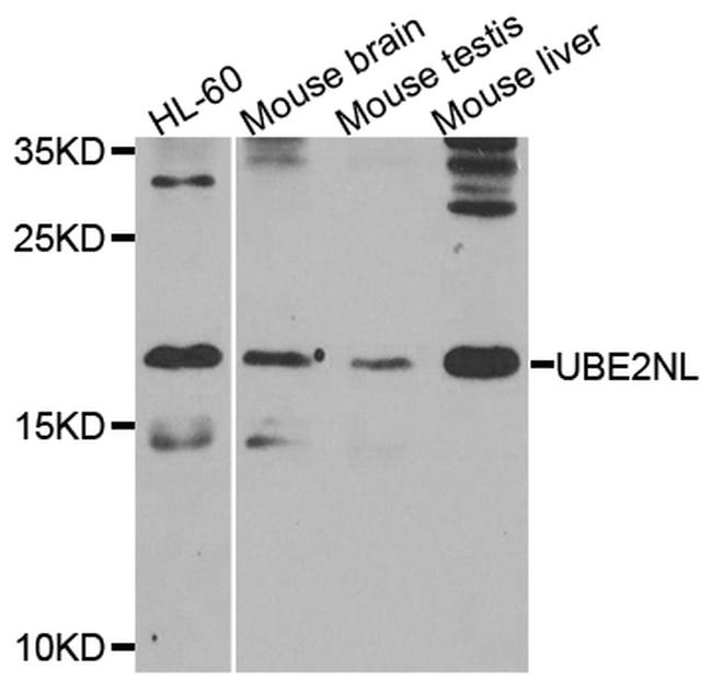 UBE2NL Antibody in Western Blot (WB)