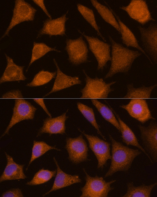 Cathepsin C Antibody in Immunocytochemistry (ICC/IF)