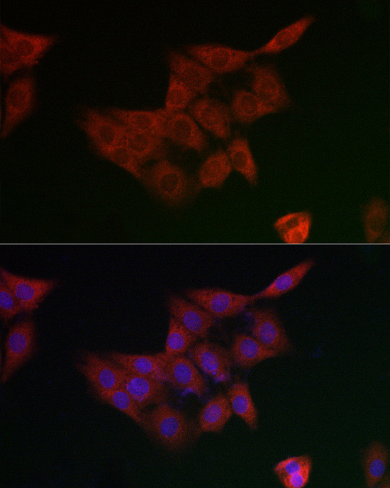 GCLM Antibody in Immunocytochemistry (ICC/IF)