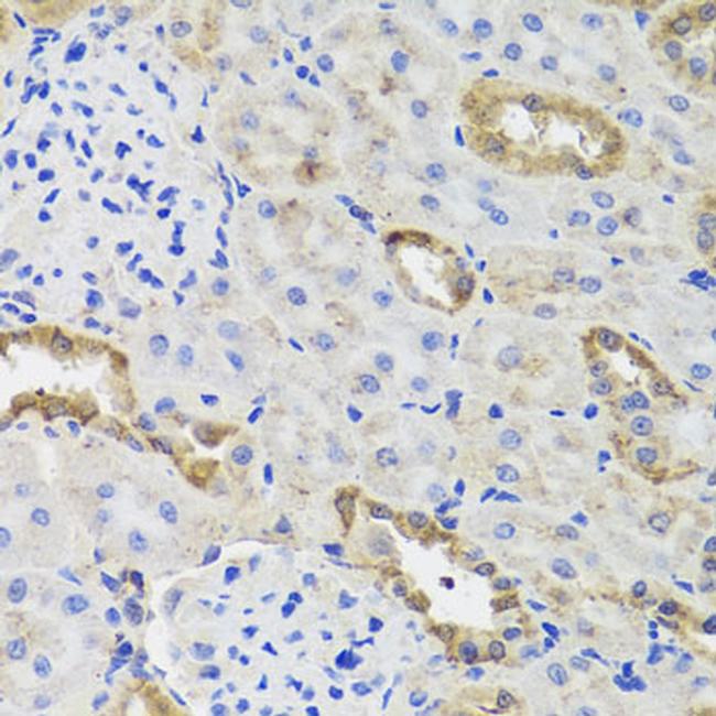 HK3 Antibody in Immunohistochemistry (Paraffin) (IHC (P))